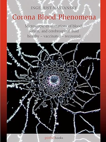 book cover image and hyperlink for: Corona Blood Phenomena: Microscopic Examinations of Blood, Serum, and Cerebrospinal Fluid: Healthy – Vaccinated – Recovered
by Inge Just-Nastansky
April 2024, Portal Books